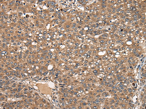 CD8A Antibody[46438]