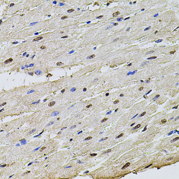SET Polyclonal Antibody[29117]
