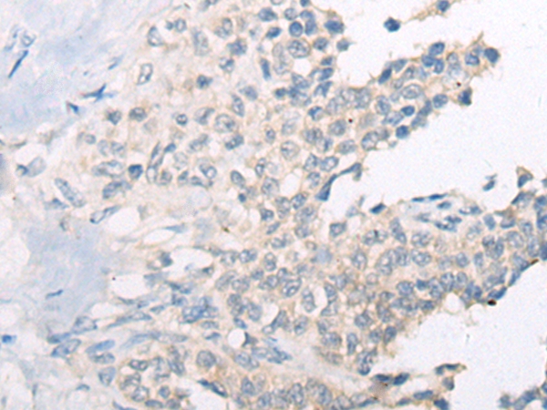 CAPN14 Antibody[46398]