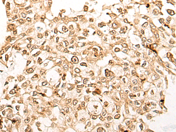 DDX27 Antibody[47039]