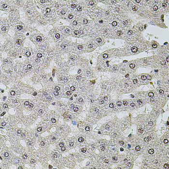 SET Polyclonal Antibody[29117]