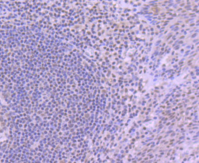 YY1 Rabbit mAb[48730]