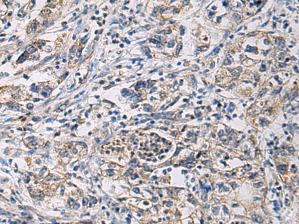 CYTIP antibody[31910]