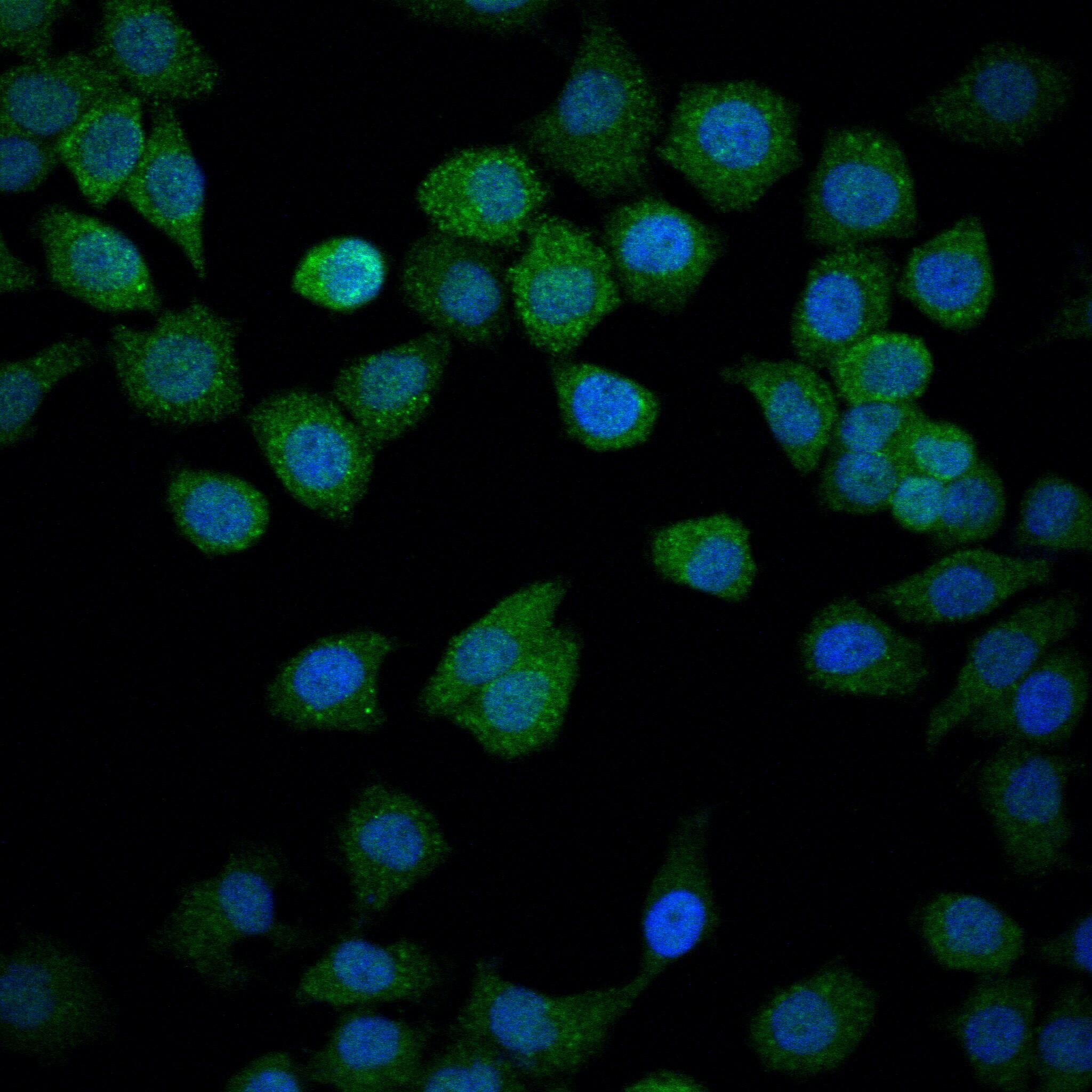 NUR77 Rabbit mAb[49510]