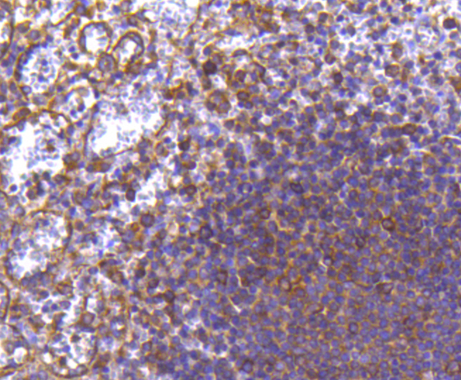 MMP11 Rabbit mAb[49045]