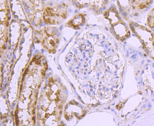 GLUT2 Rabbit mAb[49243]