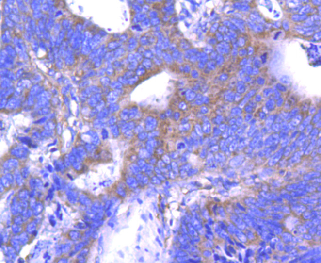 ABCF1 Rabbit mAb[49078]