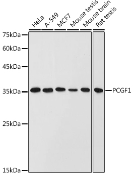 PCGF1 Polyclonal Antibody[3071
