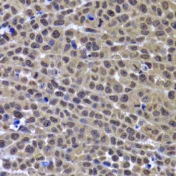 GPS1 Polyclonal Antibody[30757
