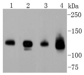 Neuropilin-1 Rabbit mAb[48906]