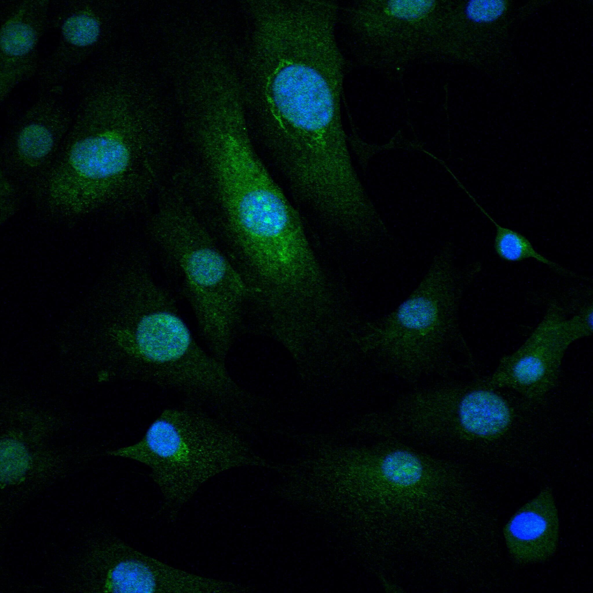 NUR77 Rabbit mAb[49510]