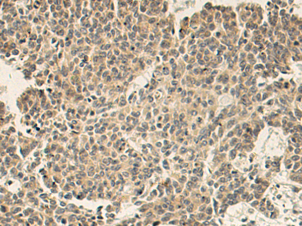 SNAP47 antibody[31815]