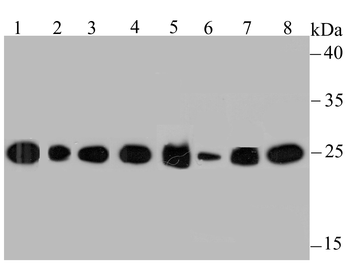HPRT Rabbit mAb[49696]