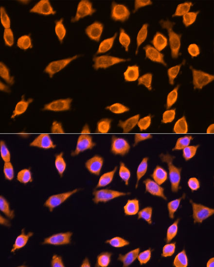 RPL17 Polyclonal Antibody[3068