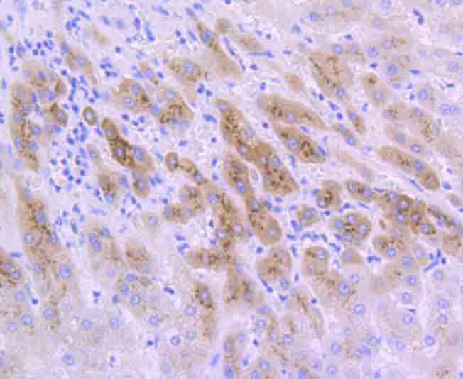IGFBP2 Rabbit mAb[49749]