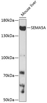 SEMA5A Polyclonal Antibody[287