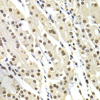 SOX5 Polyclonal Antibody[30782