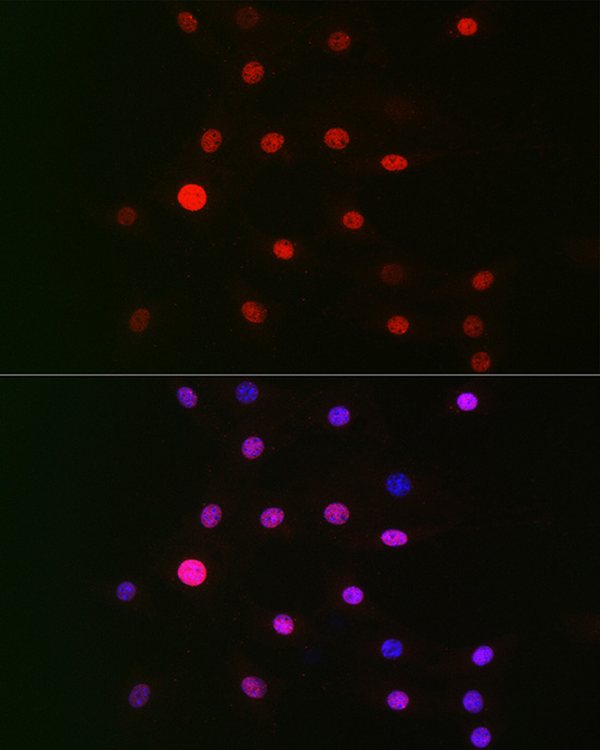 GPS1 Polyclonal Antibody[30757