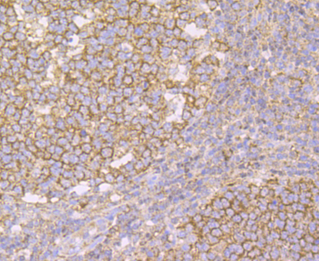 IMPDH2 Rabbit mAb[49979]