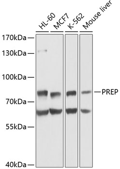 PREP Polyclonal Antibody[31751