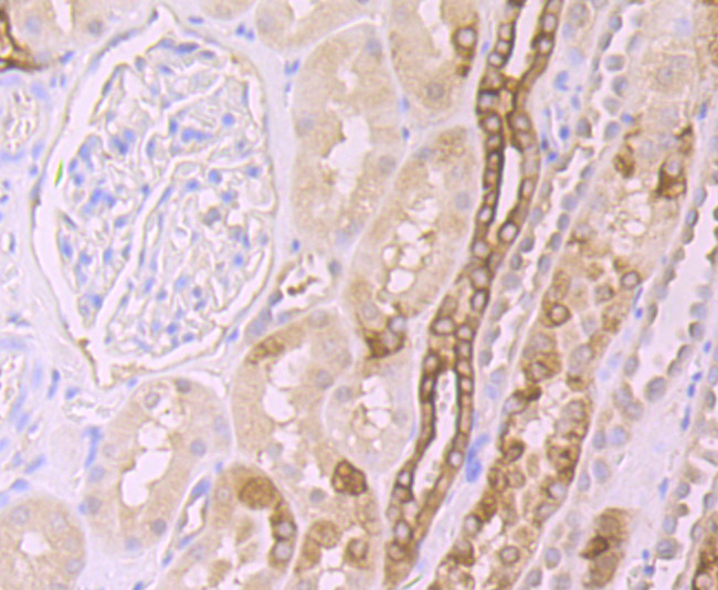 Frizzled 8 Rabbit mAb[49849]