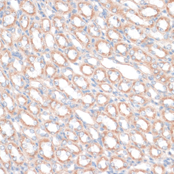 PDGFD Polyclonal Antibody[2866