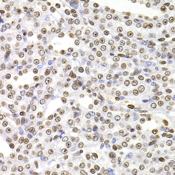SOX5 Polyclonal Antibody[30782