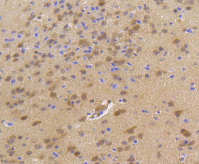 Hsp70 Rabbit mAb[48597]