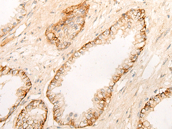 DPP9 Antibody[47076]