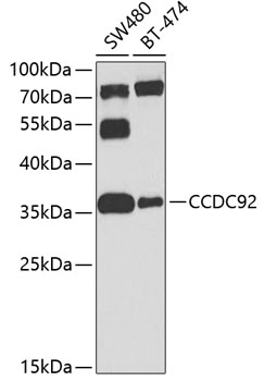 CCDC92 Polyclonal Antibody[314