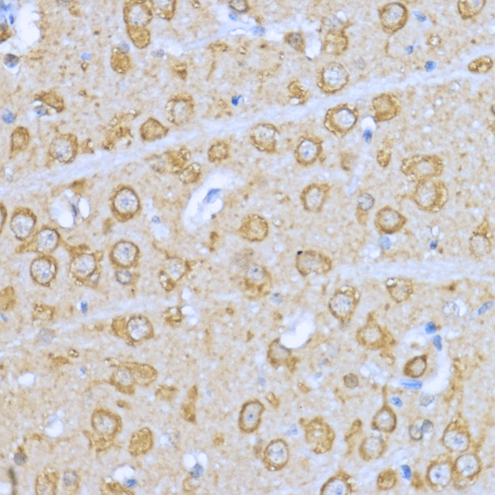 HSP90AA1 Polyclonal Antibody[2