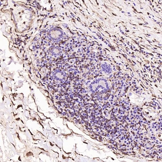 S100A4 Rabbit mAb[49121]