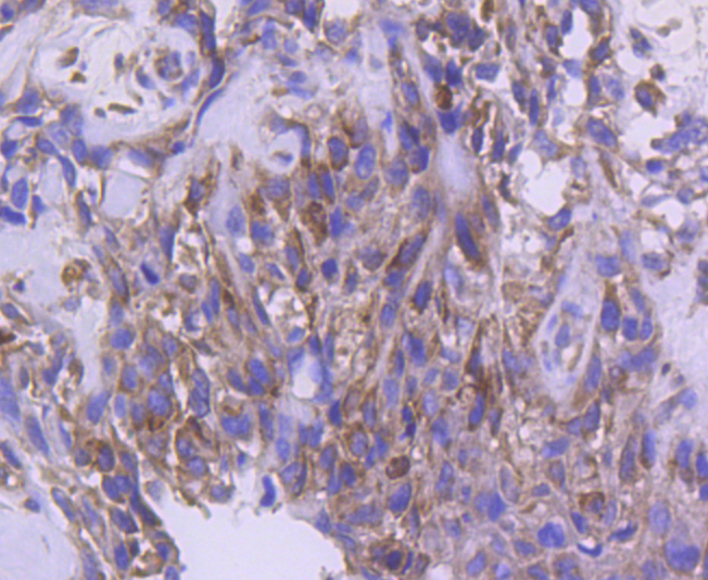 IRF5 Rabbit mAb[49111]
