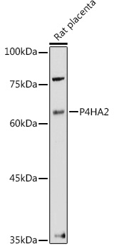 P4HA2 Polyclonal Antibody[3053
