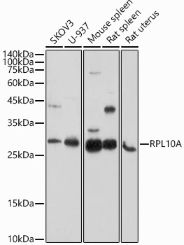 RPL10A Polyclonal Antibody[306