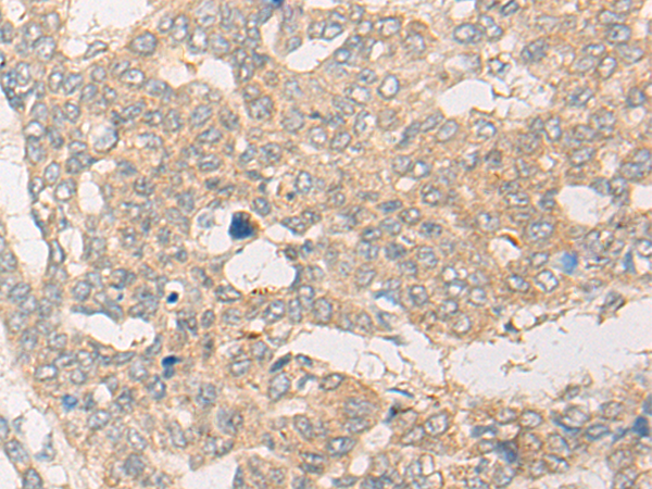 CYP7B1 Antibody[47010]