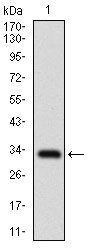 FATP2 Antibody[48437]