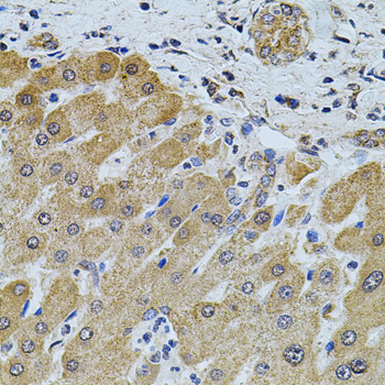FoxO3a Polyclonal Antibody[290