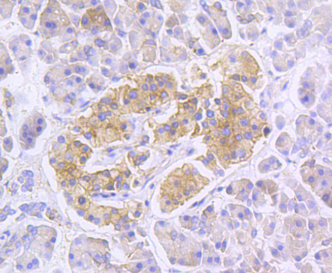 RALBP1 Rabbit mAb[49006]
