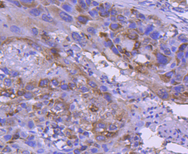 IRF5 Rabbit mAb[49111]