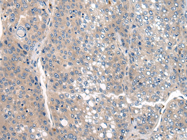 CLTCL1 Antibody[46520]