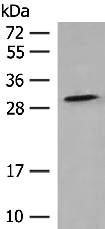 TACO1 Antibody[47762]