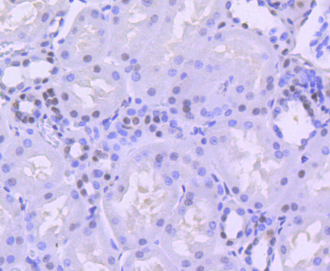 BRG1 Rabbit mAb[49101]