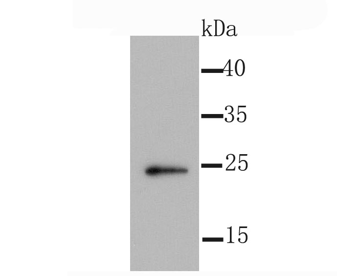 Id1 Rabbit mAb[49637]