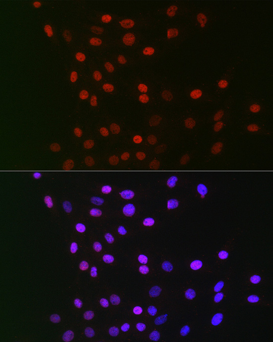 GPS1 Polyclonal Antibody[30757