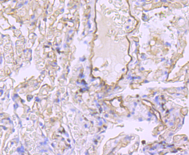Claudin 5 Rabbit mAb[49471]