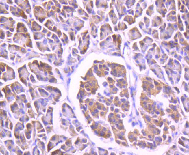 FOXO4 Rabbit mAb[49179]