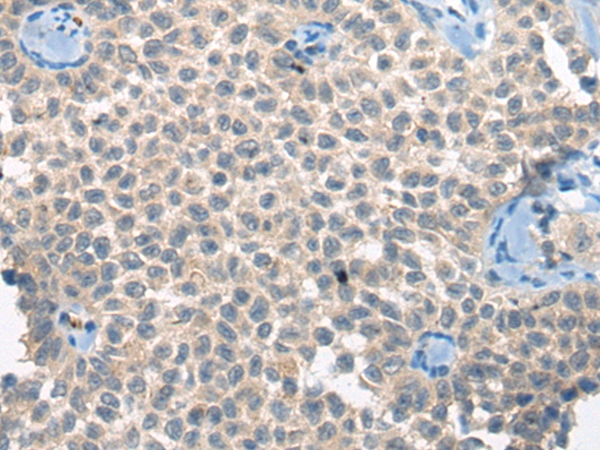 CLTCL1 Antibody[46520]