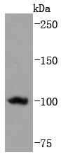 Telomerase reverse transcripta