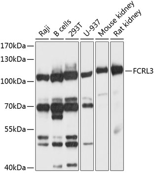 FCRL3 Polyclonal Antibody[2744
